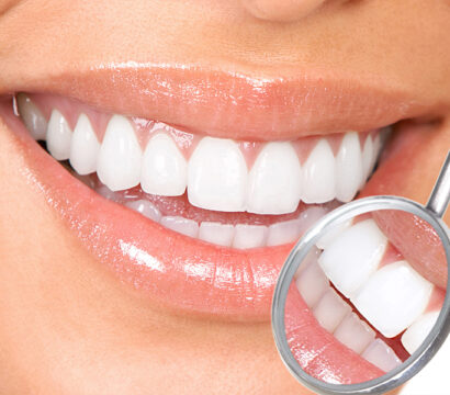 Some Benefits to Giving Your Smile an Extra Boost